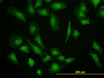 EIF4G1 monoclonal antibody (M10), clone 2A9