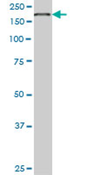EIF4G1 monoclonal antibody (M01), clone 3A10