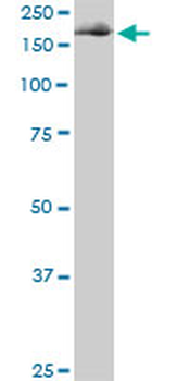 EIF4G1 monoclonal antibody (M01), clone 3A10