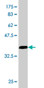 EIF4G1 monoclonal antibody (M01), clone 3A10
