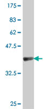 EIF4A2 polyclonal antibody (A01)