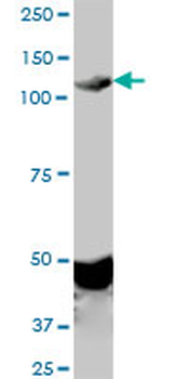 EPHA2 monoclonal antibody (M02), clone 1E3