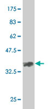 EPHA2 monoclonal antibody (M02), clone 1E3