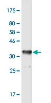 EIF2S3 monoclonal antibody (M03), clone 1H3