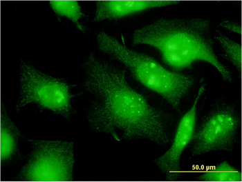 EIF2S3 monoclonal antibody (M01), clone 2C9
