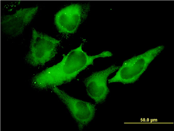 EIF2S1 monoclonal antibody (M01), clone 3H12-C11