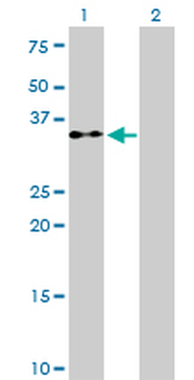 EIF2S1 monoclonal antibody (M01), clone 3H12-C11