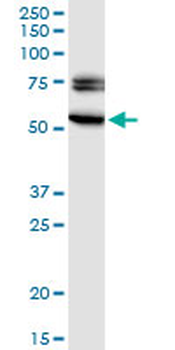 EGR2 monoclonal antibody (M03), clone 1G5