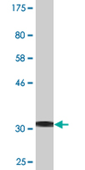 EGR2 monoclonal antibody (M03), clone 1G5