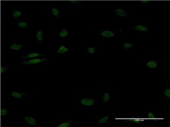 EGR1 monoclonal antibody (M08), clone 1F5