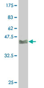EGR1 monoclonal antibody (M08), clone 1F5