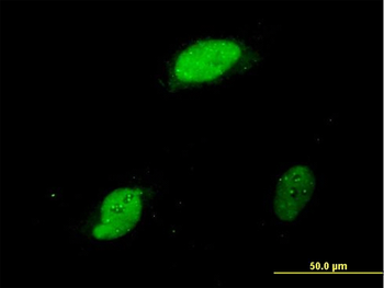 EGR1 monoclonal antibody (M03), clone 6E8