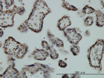 EGR1 monoclonal antibody (M03), clone 6E8