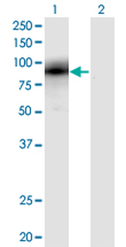 EGR1 monoclonal antibody (M03), clone 6E8
