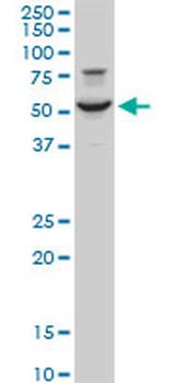 EGR1 polyclonal antibody (A01)