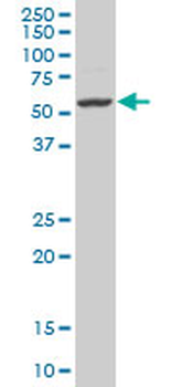 EGR1 polyclonal antibody (A01)