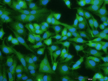 EGFR purified MaxPab rabbit polyclonal antibody (D01P)