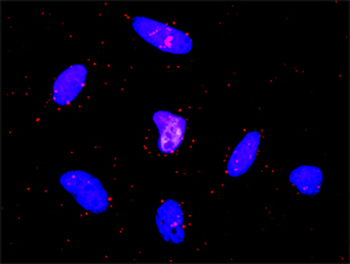 EGFR purified MaxPab rabbit polyclonal antibody (D01P)