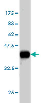 CELSR3 monoclonal antibody (M01), clone 2F7