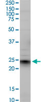 EFNA5 monoclonal antibody (M01), clone 1F12