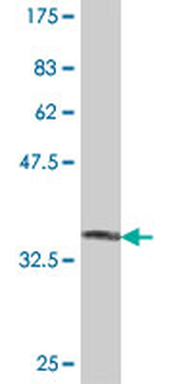 EFNA5 polyclonal antibody (A01)