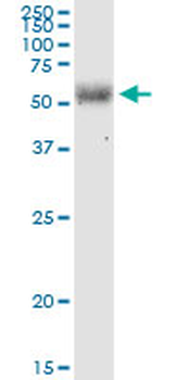 EIF2D monoclonal antibody (M05), clone 2D10