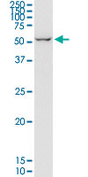 EIF2D monoclonal antibody (M05), clone 2D10