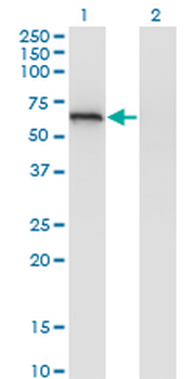 EIF2D monoclonal antibody (M05), clone 2D10