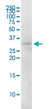 EEF1B2 monoclonal antibody (M18), clone 2G10