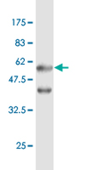 EEF1B2 monoclonal antibody (M18), clone 2G10