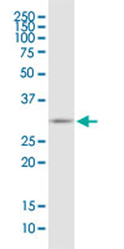 EEF1B2 monoclonal antibody (M14), clone 2G6