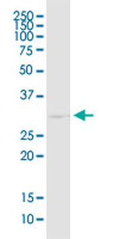 EEF1B2 monoclonal antibody (M14), clone 2G6