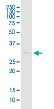 EEF1B2 monoclonal antibody (M14), clone 2G6