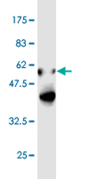 EEF1B2 monoclonal antibody (M14), clone 2G6