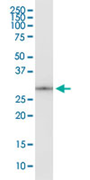 EEF1B2 monoclonal antibody (M12), clone 3F9