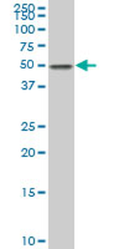 EEF1A2 polyclonal antibody (A01)