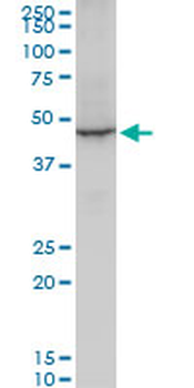 EEF1A2 polyclonal antibody (A01)