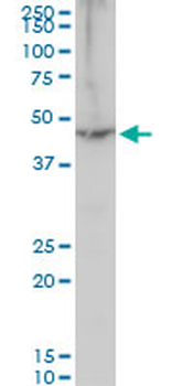 EEF1A2 polyclonal antibody (A01)