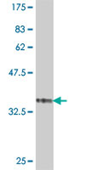 EEF1A2 polyclonal antibody (A01)