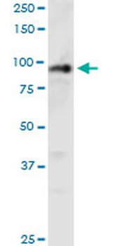 PHC1 monoclonal antibody (M05), clone 3G1