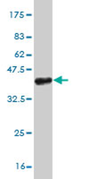 PHC1 monoclonal antibody (M05), clone 3G1