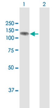PHC1 MaxPab rabbit polyclonal antibody (D01)