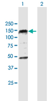 PHC1 purified MaxPab mouse polyclonal antibody (B01P)