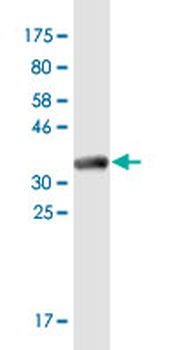 EDNRB monoclonal antibody (M01), clone 5H2