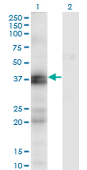 EDNRA monoclonal antibody (M02), clone 2A5