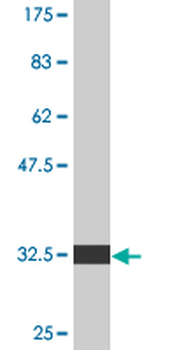 EDNRA monoclonal antibody (M02), clone 2A5