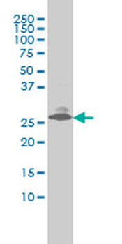 EDN3 monoclonal antibody (M01), clone 2A6-2A4