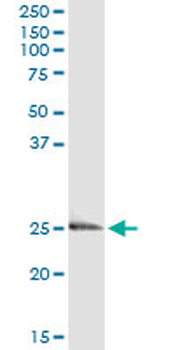 EDN3 monoclonal antibody (M01), clone 2A6-2A4