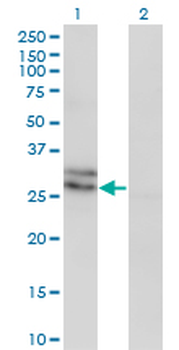 EDN3 monoclonal antibody (M01), clone 2A6-2A4