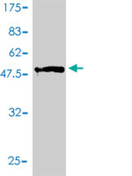EDN3 monoclonal antibody (M01), clone 2A6-2A4